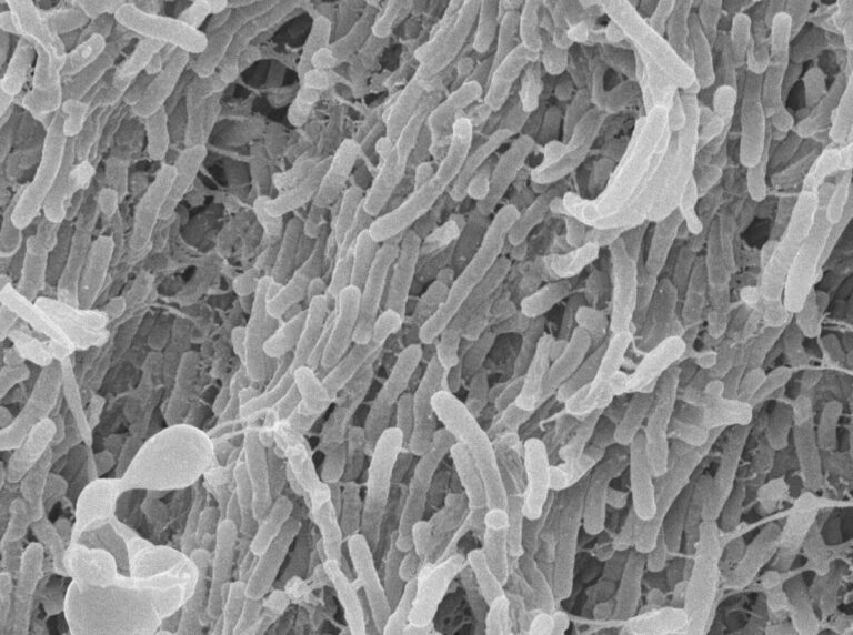 Le Japon lance les vérifications de la TB avant l'entrée pour les vietnamiens séjournant plus de 3 mois