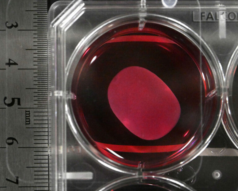 Le Japon approuve la commercialisation de 2 médicaments dérivés de l'iPS dans le cadre d'une première mondiale