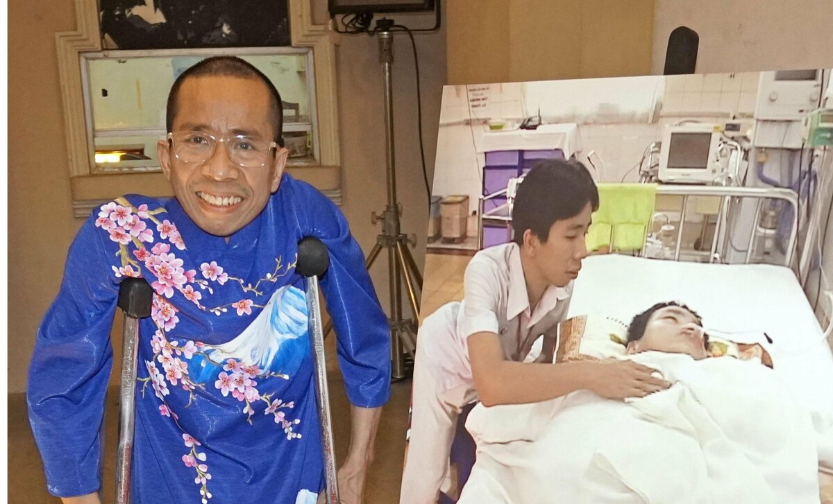 Un jumeau vietnamien autrefois siamois visitera les régions touchées par la maladie de Minamata au Japon